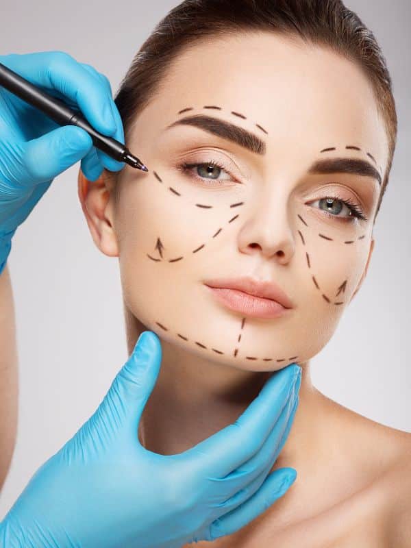 patient with Plastic Surgery marks in face before surgery