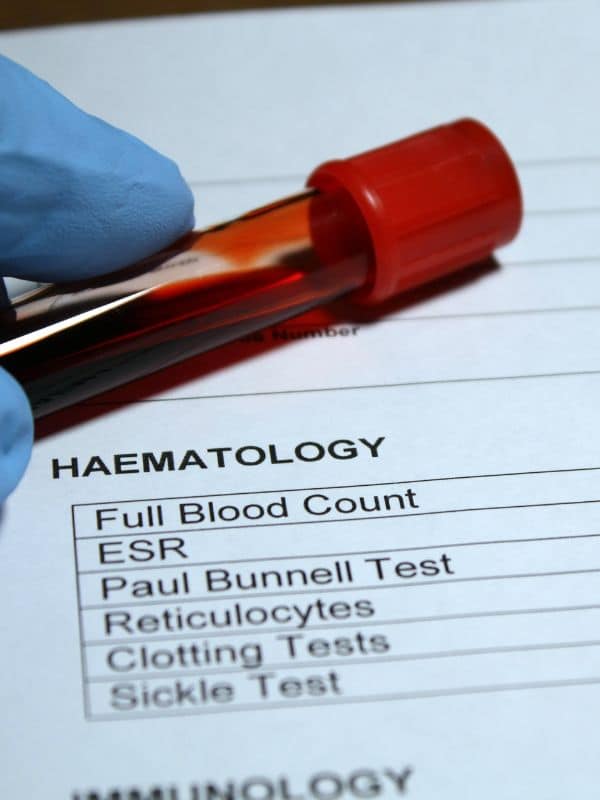 Blood filled In test Tube